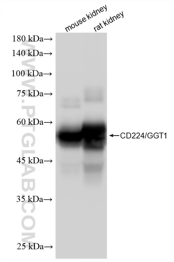 Western Blot (WB) analysis of various lysates using GGT1 Recombinant monoclonal antibody (87659-1-RR)