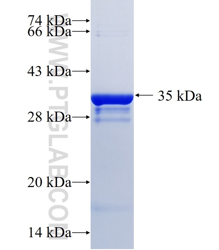 GGT1 fusion protein Ag34209 SDS-PAGE