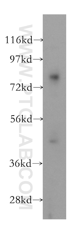 Western Blot (WB) analysis of HEK-293 cells using GGT5 Polyclonal antibody (12002-1-AP)