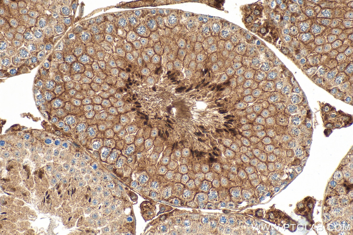 Immunohistochemistry (IHC) staining of mouse testis tissue using GGT5 Polyclonal antibody (30148-1-AP)