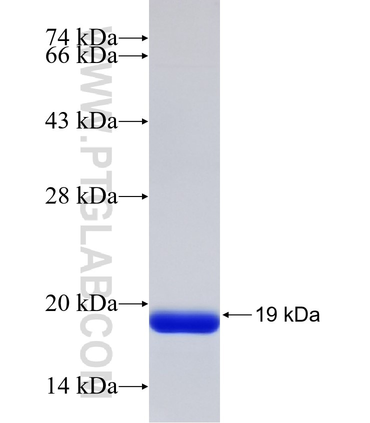 GGT5 fusion protein Ag32373 SDS-PAGE