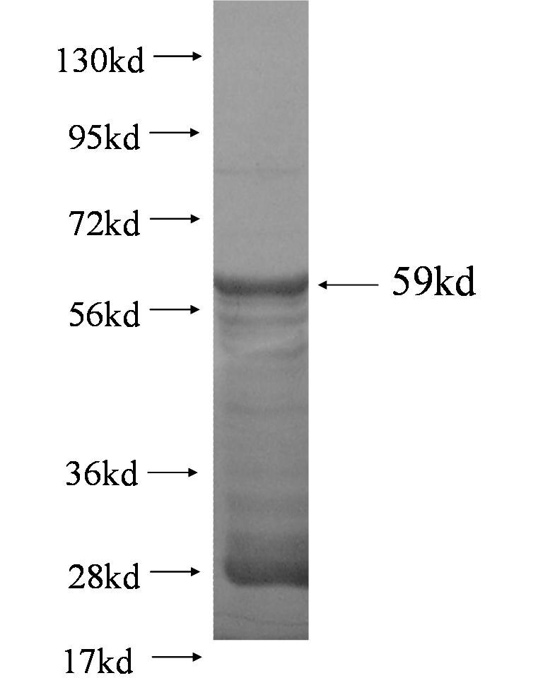 GGT5 fusion protein Ag2641 SDS-PAGE