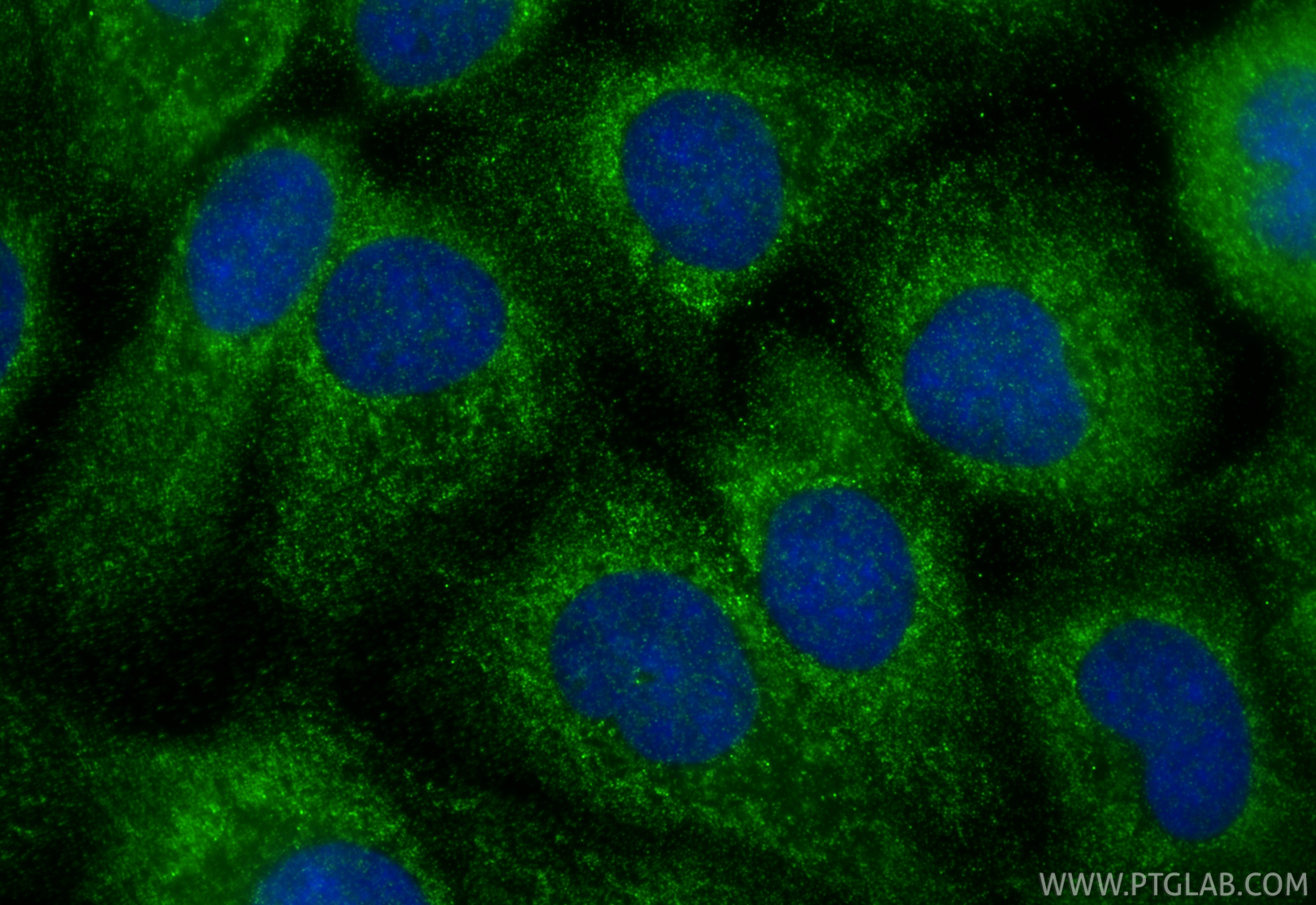 IF Staining of A431 using 33436-1-AP Immunofluorescence (IF) / fluorescent staining of A431 cells using GGT6 Polyclonal antibody (33436-1-AP)