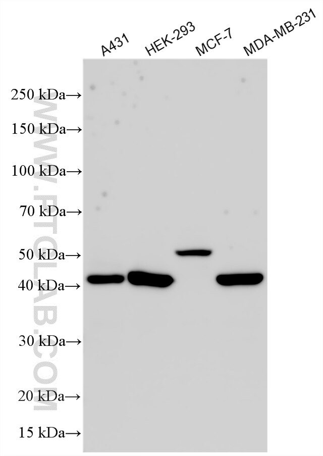 WB analysis using 33436-1-AP Western Blot (WB) analysis of various lysates using GGT6 Polyclonal antibody (33436-1-AP)