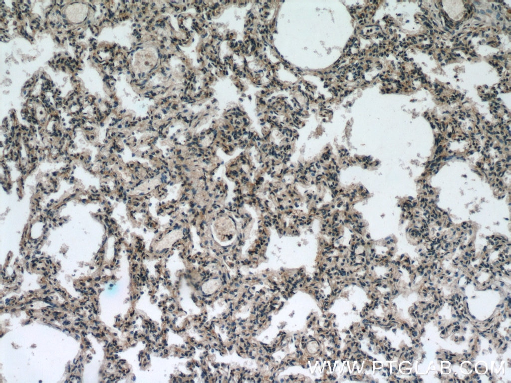 Immunohistochemistry (IHC) staining of human lung tissue using GGT7 Polyclonal antibody (24674-1-AP)