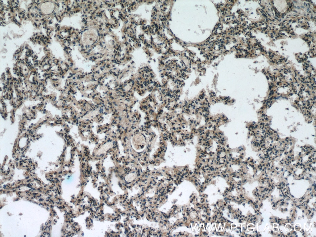 IHC staining of human lung using 24674-1-AP