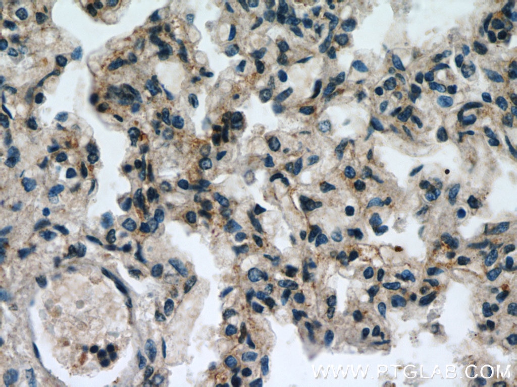 Immunohistochemistry (IHC) staining of human lung tissue using GGT7 Polyclonal antibody (24674-1-AP)