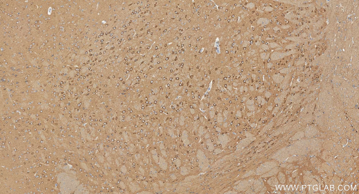 Immunohistochemistry (IHC) staining of mouse brain tissue using GGT7 Polyclonal antibody (24674-1-AP)