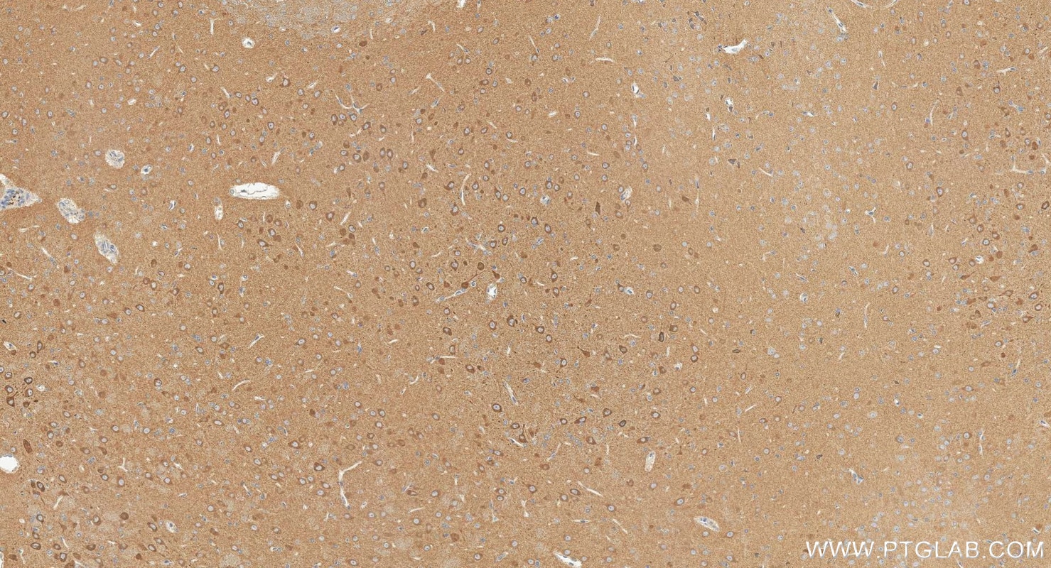 Immunohistochemistry (IHC) staining of rat brain tissue using GGT7 Polyclonal antibody (24674-1-AP)