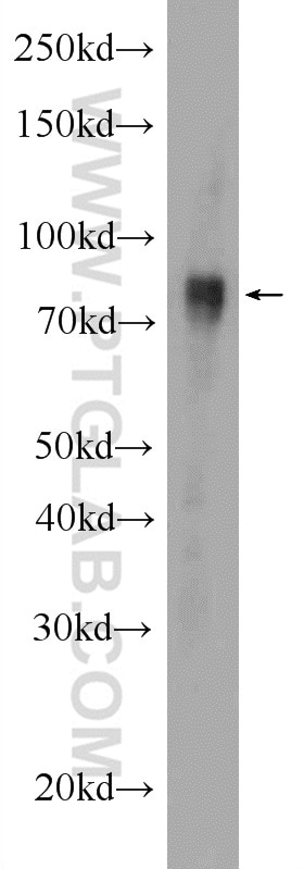 Western Blot (WB) analysis of HEK-293 cells using GGT7 Polyclonal antibody (24674-1-AP)