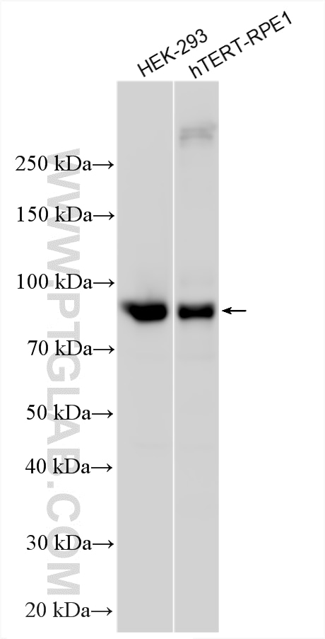 Western Blot (WB) analysis of various lysates using GGT7 Polyclonal antibody (24674-1-AP)
