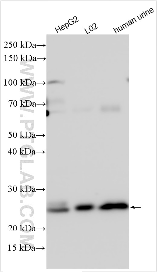 GGTLC1