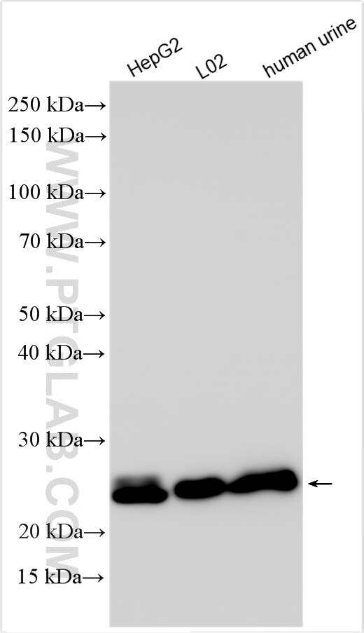 Western Blot (WB) analysis of various lysates using GGTLC1 Recombinant antibody (83392-3-RR)
