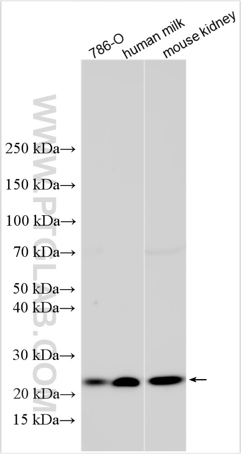 Western Blot (WB) analysis of various lysates using GGTLC2 Polyclonal antibody (18191-1-AP)