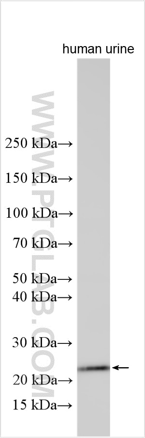 Western Blot (WB) analysis of various lysates using GGTLC2 Polyclonal antibody (18191-1-AP)