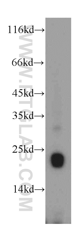 GH1 Polyclonal antibody