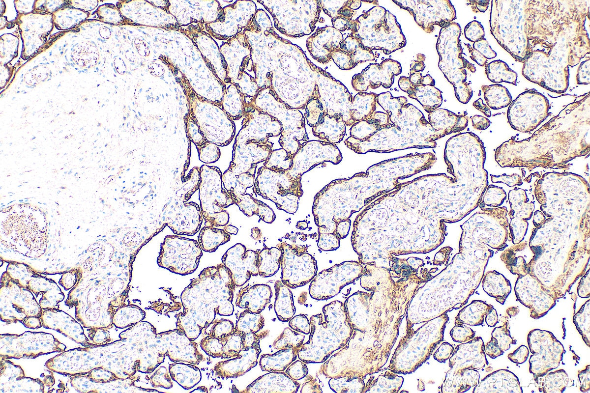 Immunohistochemistry (IHC) staining of human placenta tissue using Growth Hormone Polyclonal antibody (30345-1-AP)