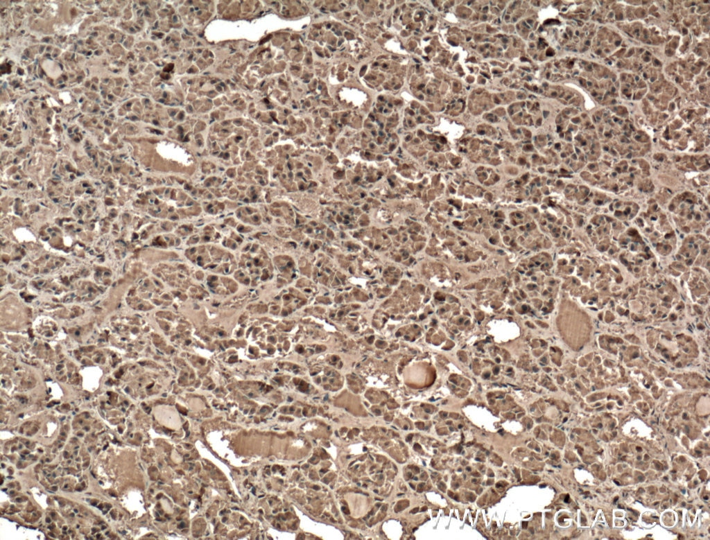 Immunohistochemistry (IHC) staining of human pituitary tissue using GH1 Polyclonal antibody (55243-1-AP)
