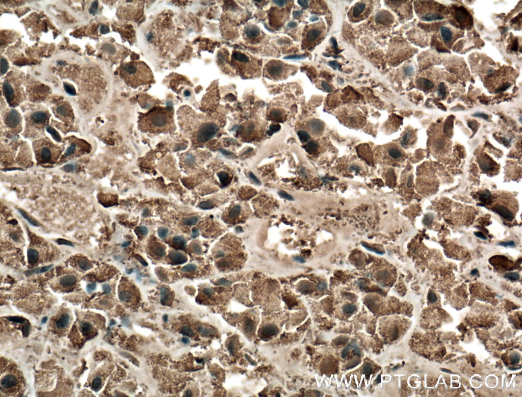 Immunohistochemistry (IHC) staining of human pituitary tissue using GH1 Polyclonal antibody (55243-1-AP)