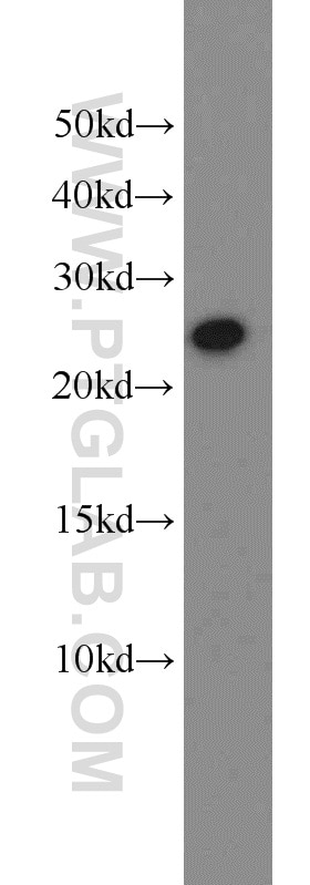 WB analysis of human placenta using 55243-1-AP