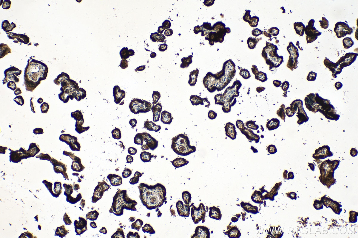 Immunohistochemistry (IHC) staining of human placenta tissue using GH1 Recombinant antibody (82813-2-RR)