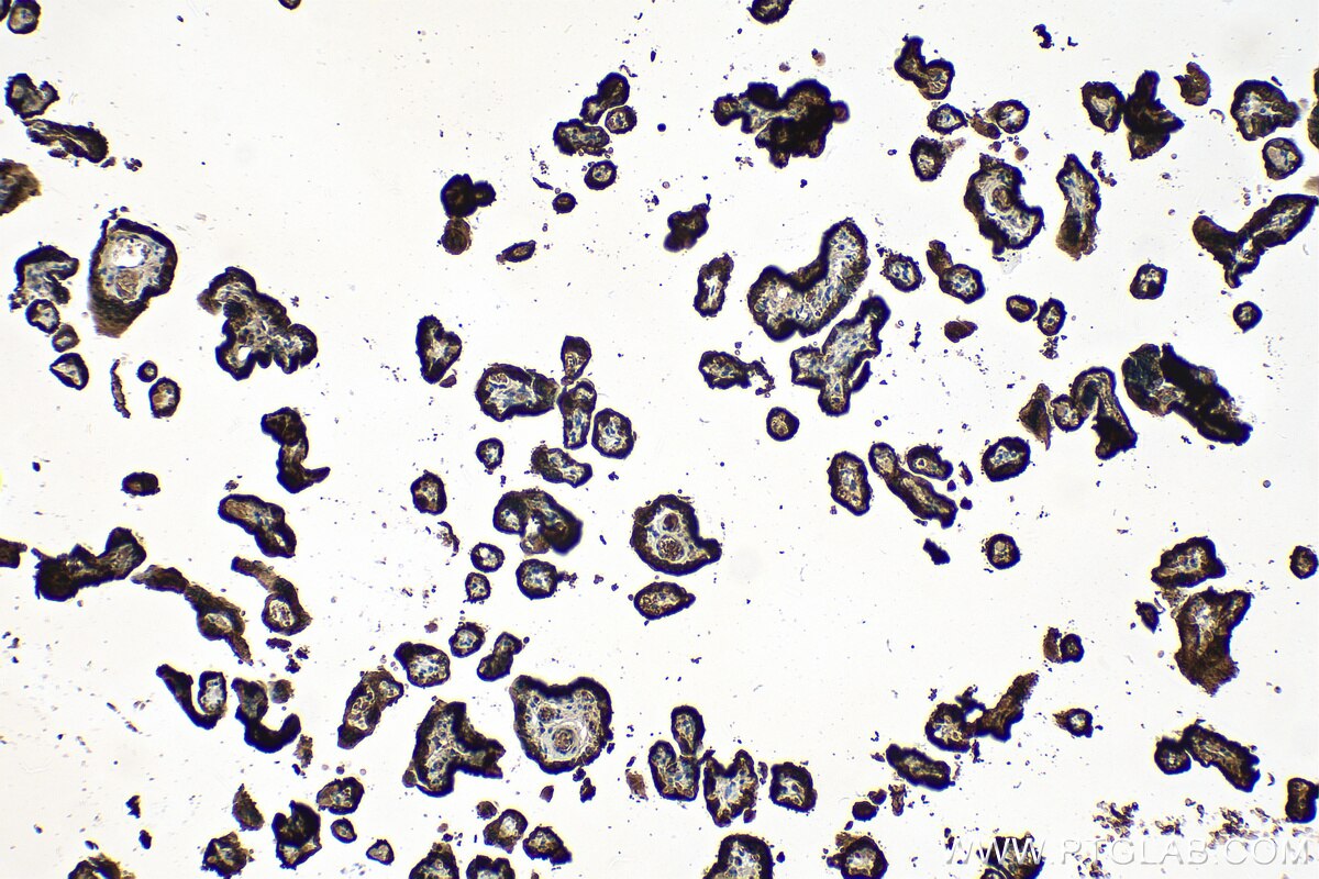 IHC staining of human placenta using 82813-2-RR