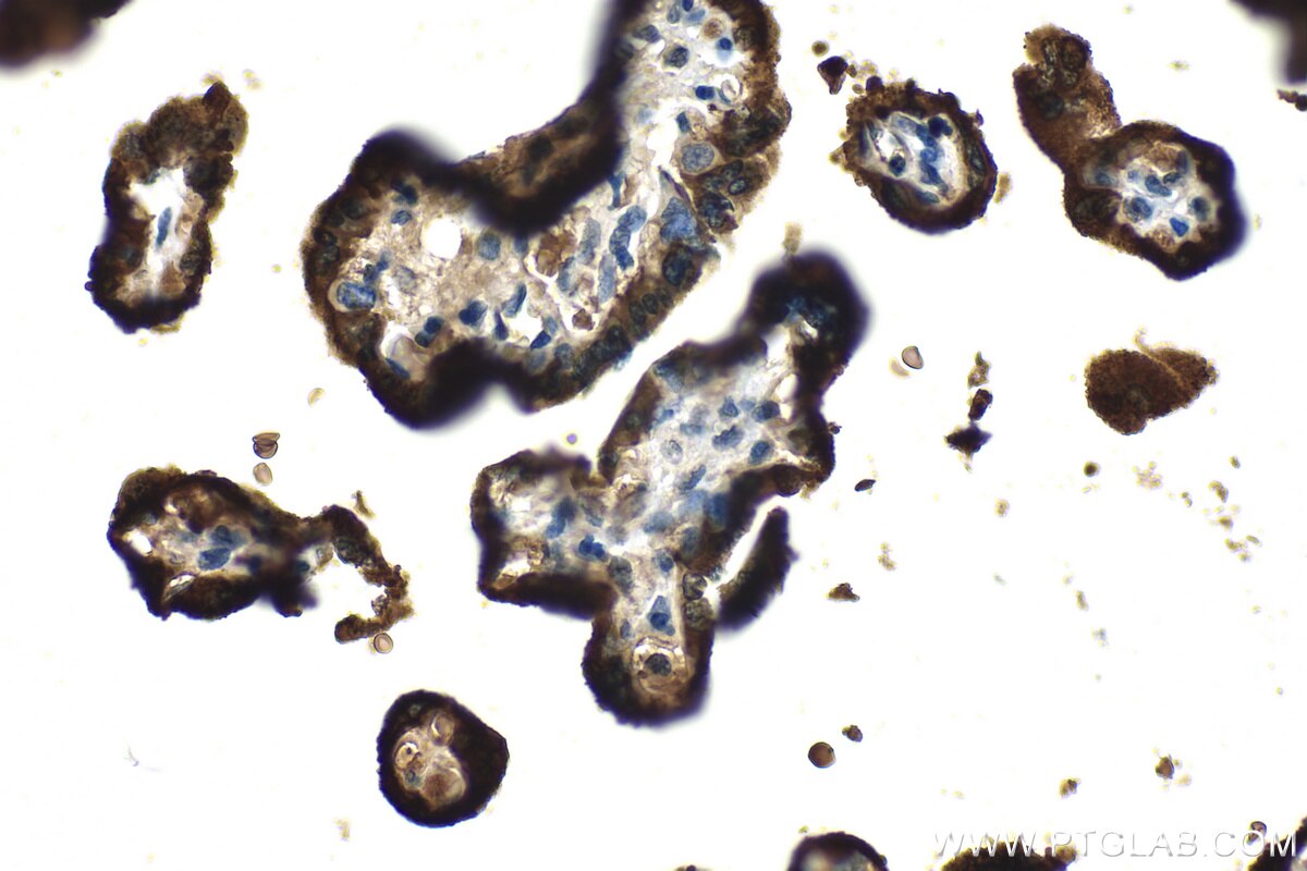 Immunohistochemistry (IHC) staining of human placenta tissue using GH1 Recombinant antibody (82813-2-RR)