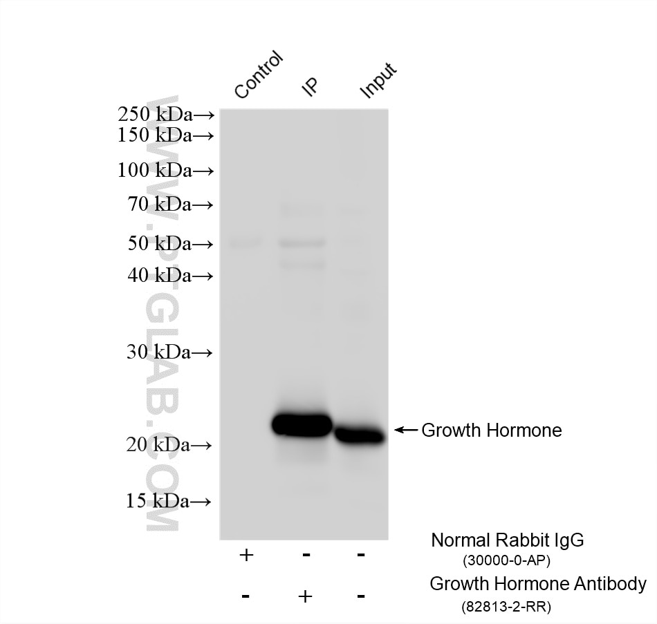 Immunoprecipitation (IP) experiment of human placenta tissue using Growth Hormone Recombinant monoclonal antibody (82813-2-RR)