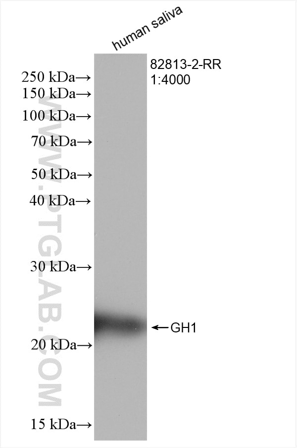 Western Blot (WB) analysis of various lysates using GH1 Recombinant antibody (82813-2-RR)