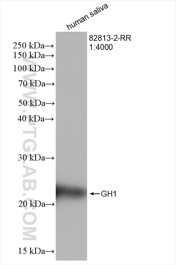 Western Blot (WB) analysis of various lysates using Growth Hormone Recombinant antibody (82813-2-RR)