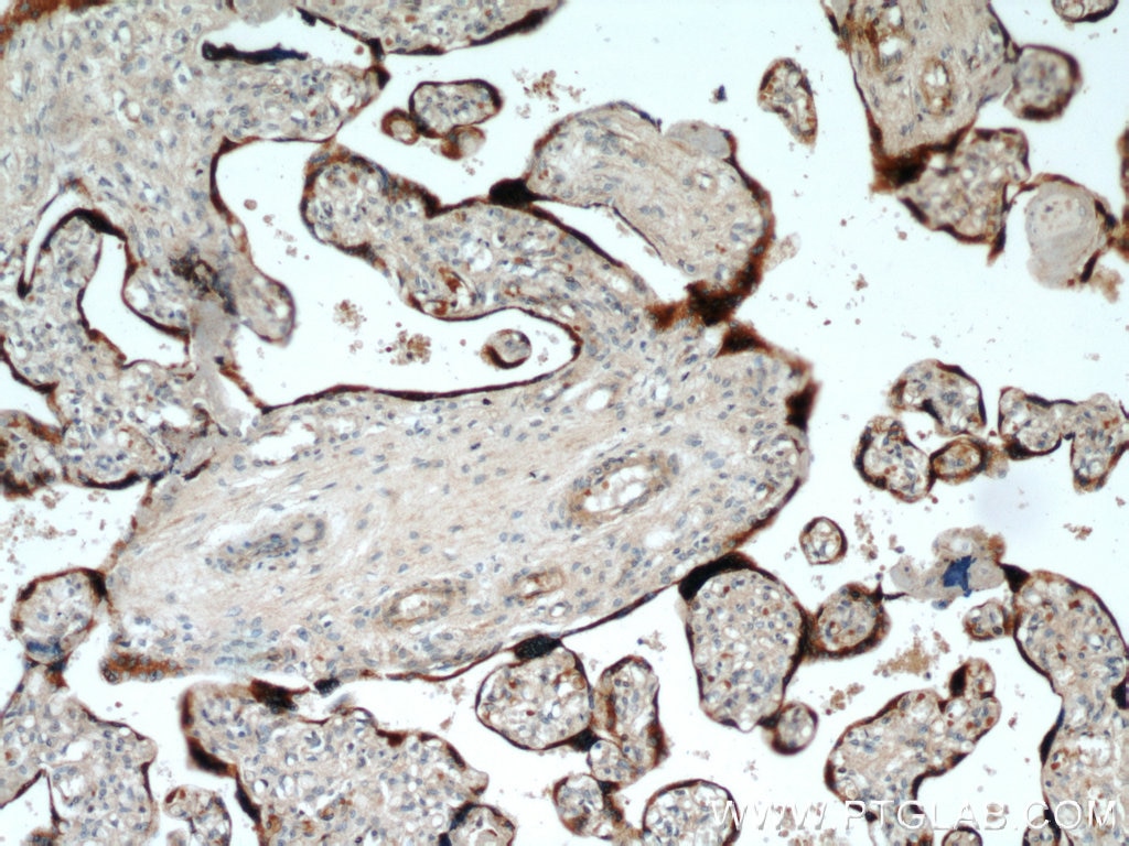 Immunohistochemistry (IHC) staining of human placenta tissue using GH2 Polyclonal antibody (55240-1-AP)