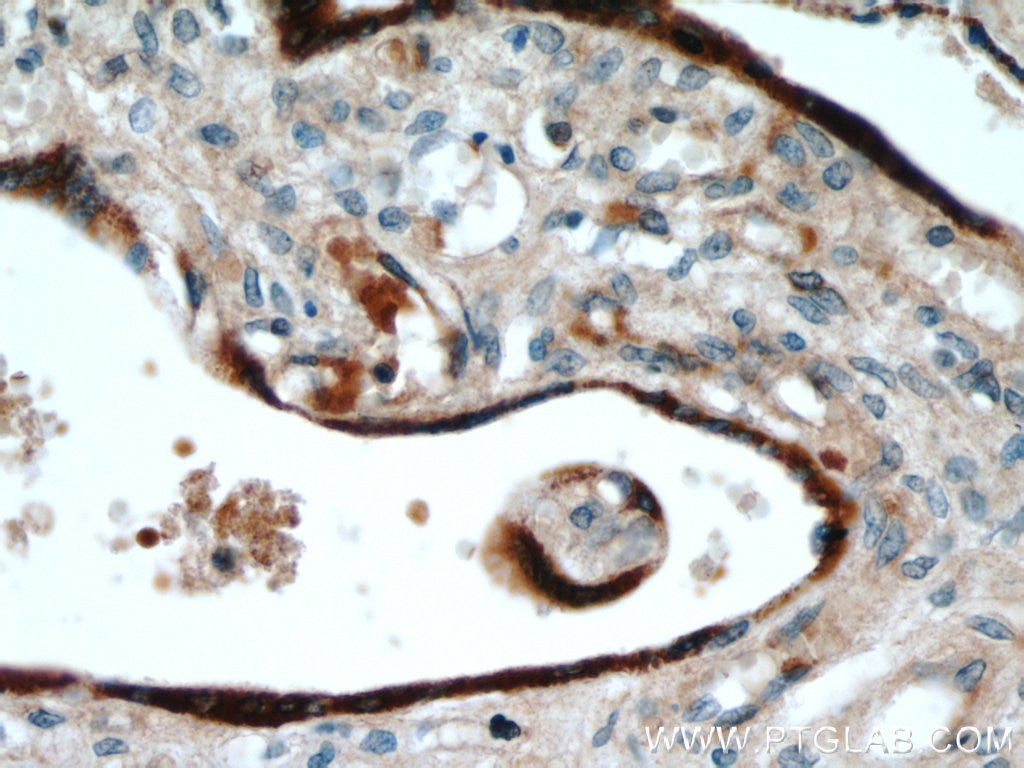 Immunohistochemistry (IHC) staining of human placenta tissue using GH2 Polyclonal antibody (55240-1-AP)