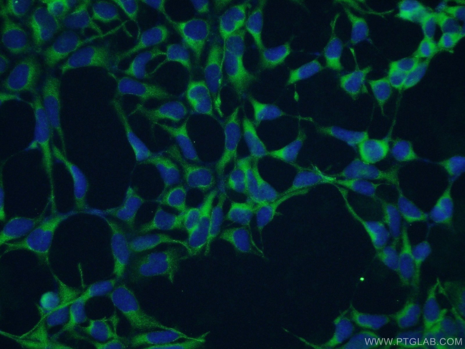 Immunofluorescence (IF) / fluorescent staining of HEK-293 cells using GHDC Polyclonal antibody (26123-1-AP)