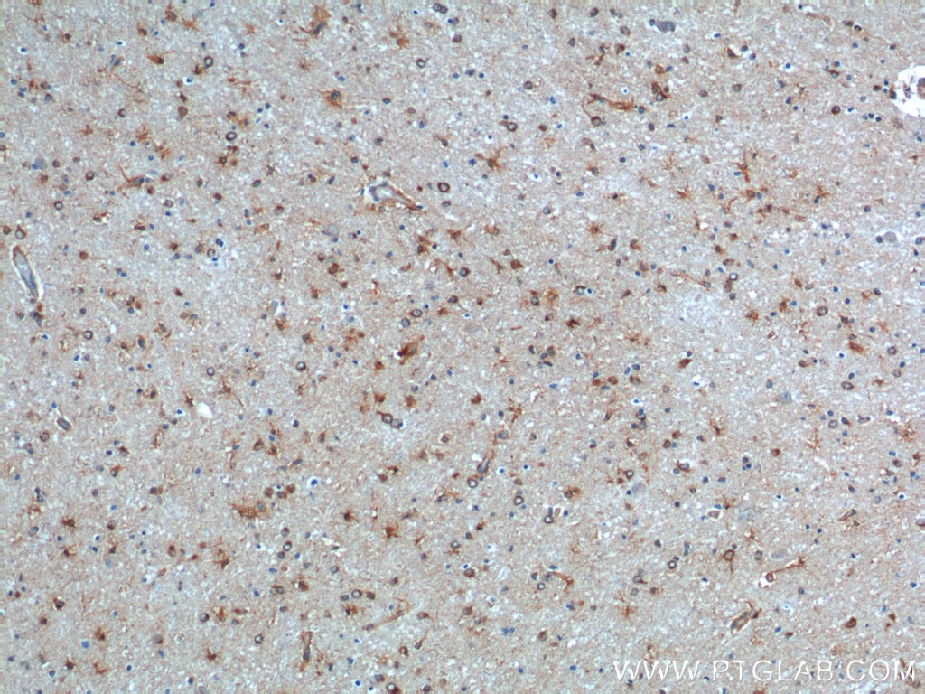 Immunohistochemistry (IHC) staining of human brain tissue using GHDC Polyclonal antibody (26123-1-AP)