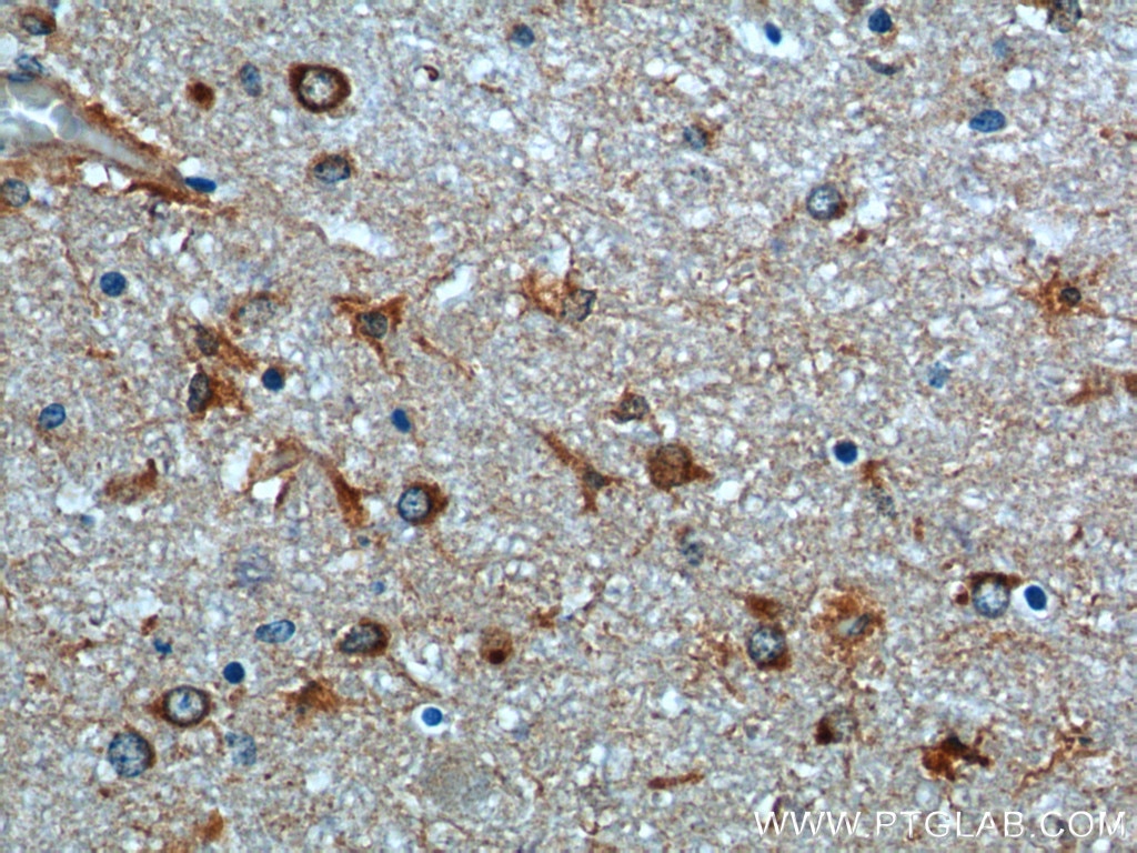 Immunohistochemistry (IHC) staining of human brain tissue using GHDC Polyclonal antibody (26123-1-AP)