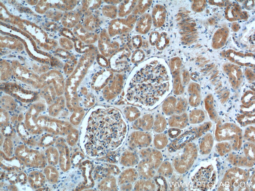 Immunohistochemistry (IHC) staining of human kidney tissue using GHDC Polyclonal antibody (26123-1-AP)