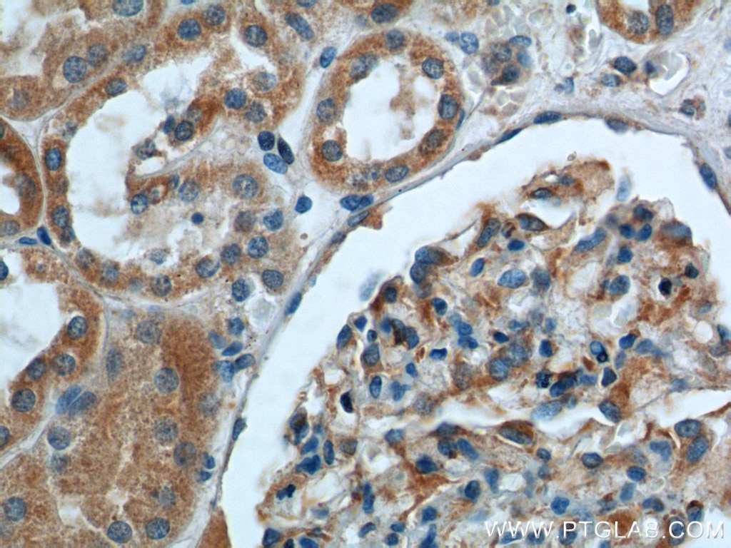Immunohistochemistry (IHC) staining of human kidney tissue using GHDC Polyclonal antibody (26123-1-AP)