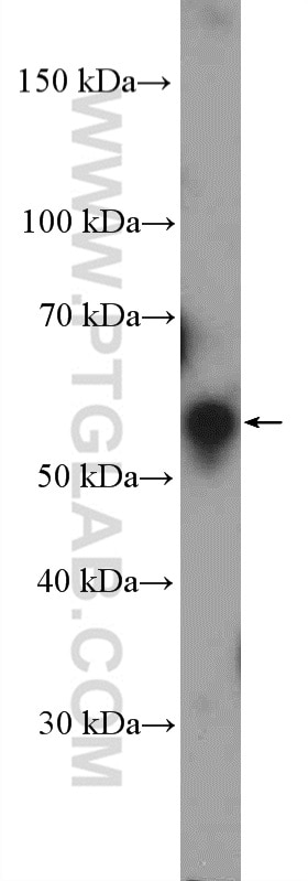 Western Blot (WB) analysis of HEK-293 cells using GHDC Polyclonal antibody (26123-1-AP)