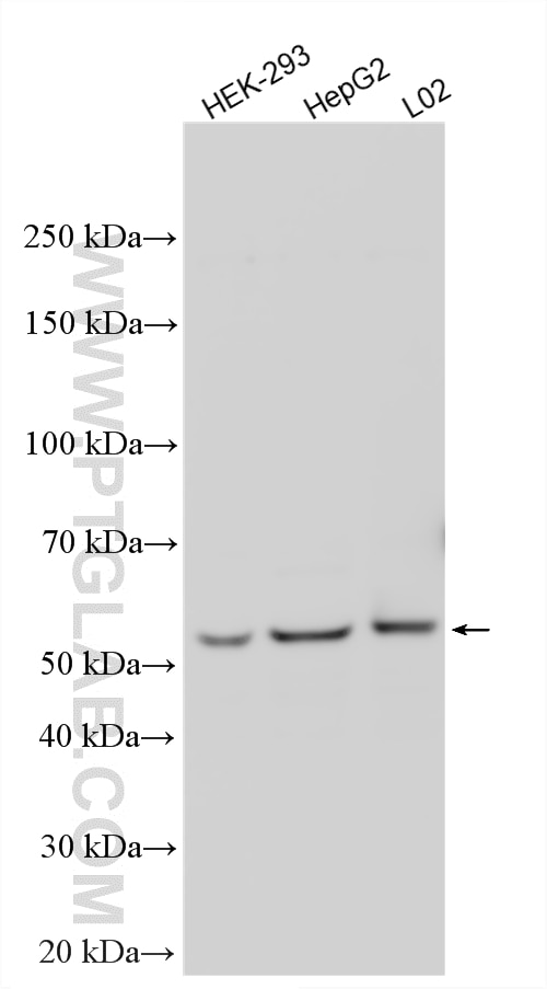 Western Blot (WB) analysis of various lysates using GHDC Polyclonal antibody (26123-1-AP)