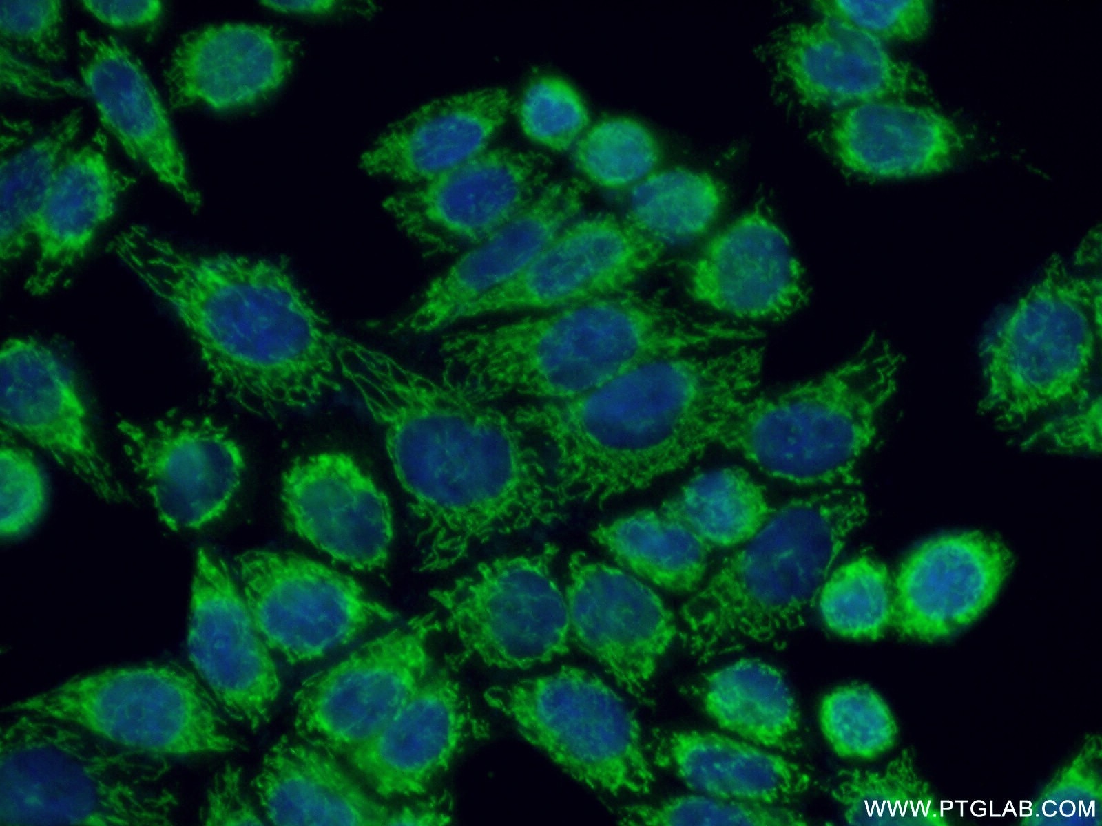 Immunofluorescence (IF) / fluorescent staining of HeLa cells using GHITM Polyclonal antibody (16296-1-AP)