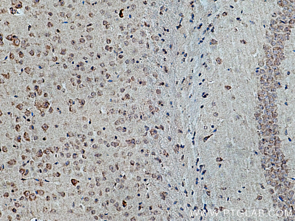 IHC staining of mouse brain using 16296-1-AP