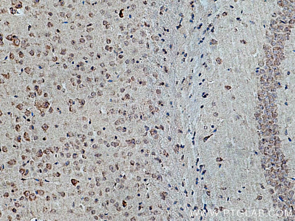 Immunohistochemistry (IHC) staining of mouse brain tissue using GHITM Polyclonal antibody (16296-1-AP)