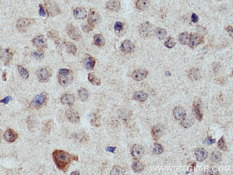 Immunohistochemistry (IHC) staining of mouse brain tissue using GHITM Polyclonal antibody (16296-1-AP)