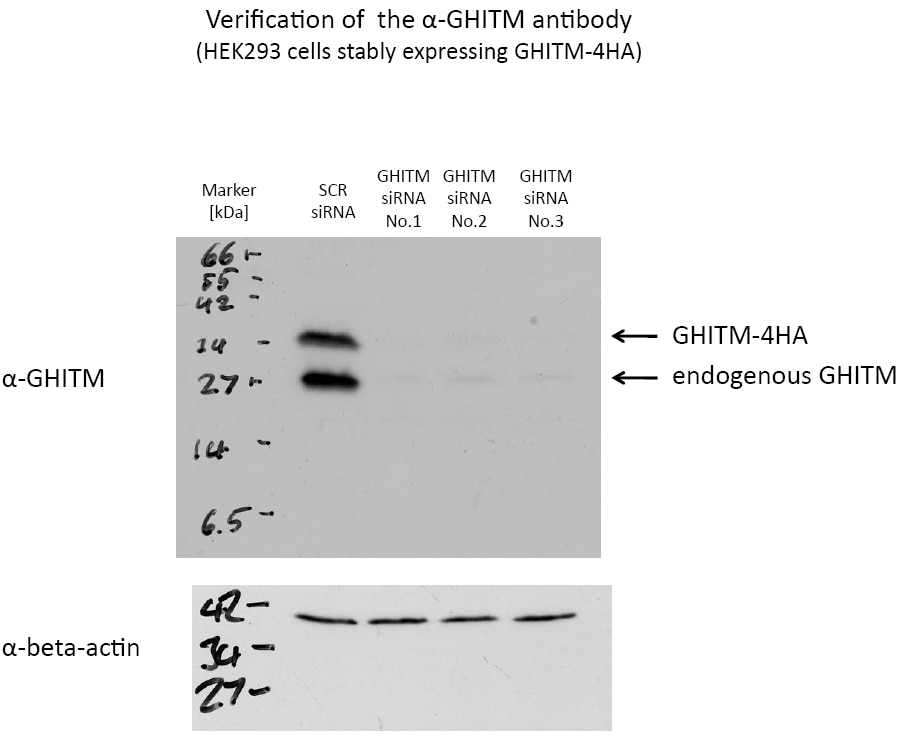 Western Blot (WB) analysis of HEK-293 cells using GHITM Polyclonal antibody (16296-1-AP)