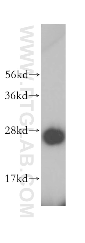 Western Blot (WB) analysis of HeLa cells using GHITM Polyclonal antibody (16296-1-AP)