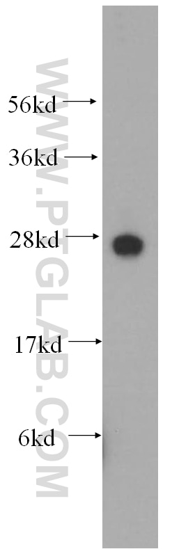 Western Blot (WB) analysis of SH-SY5Y cells using GHITM Polyclonal antibody (16296-1-AP)