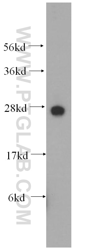 WB analysis of SH-SY5Y using 16296-1-AP