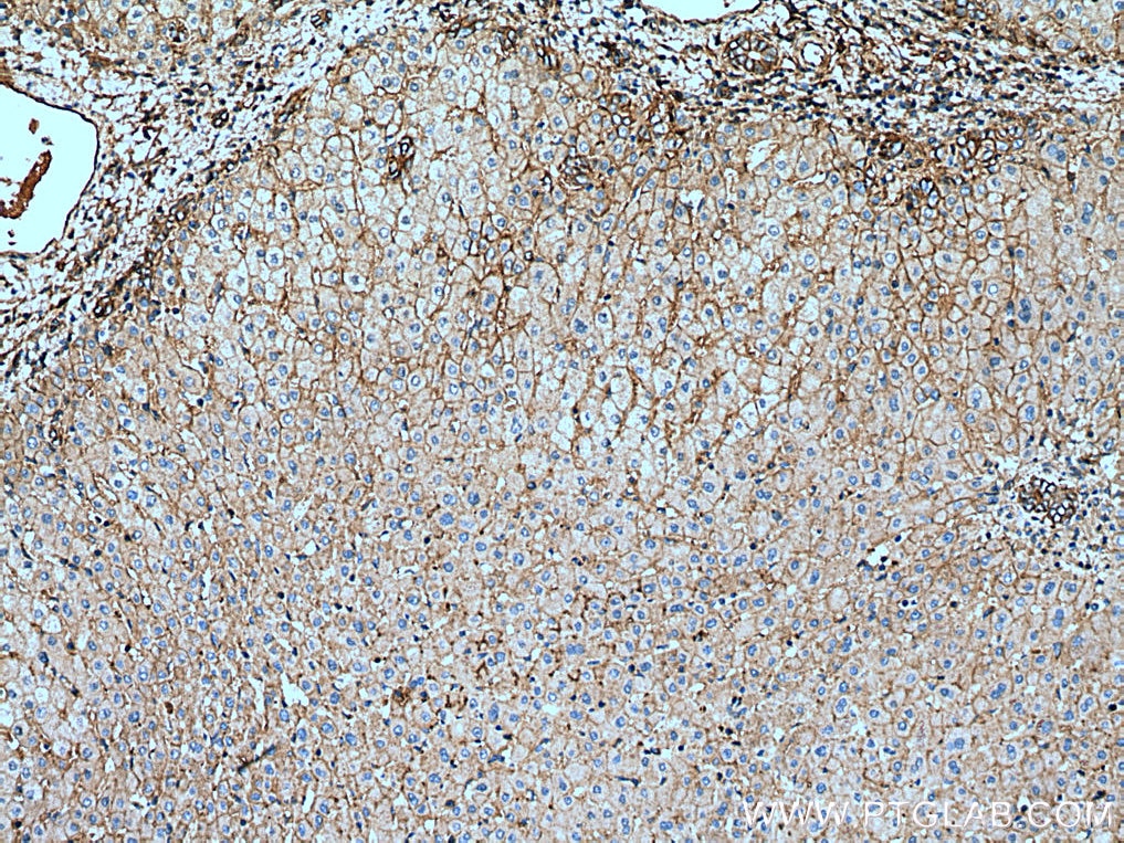 IHC staining of human liver using 20713-1-AP