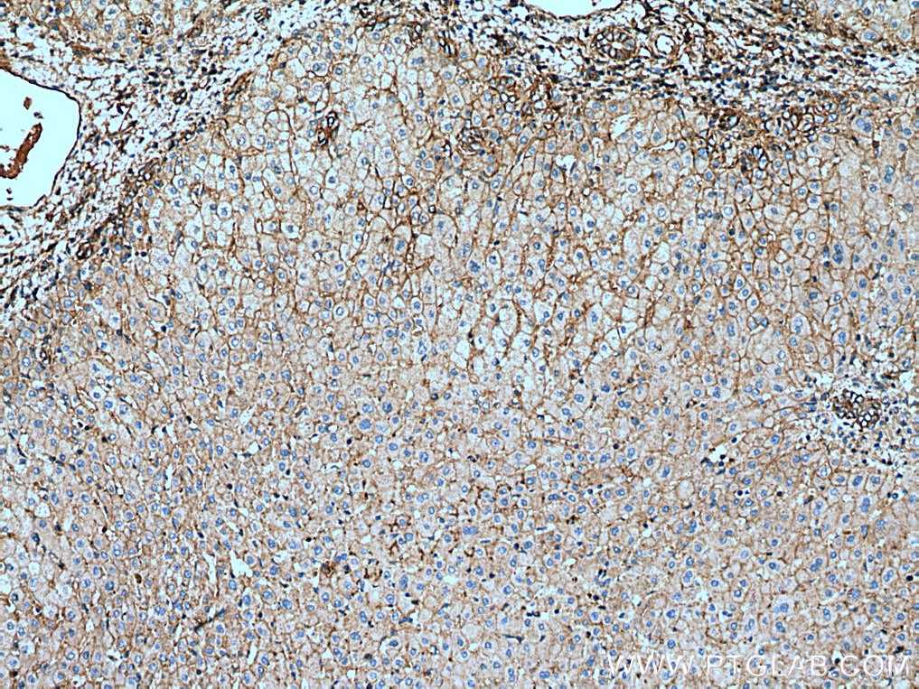 Immunohistochemistry (IHC) staining of human liver tissue using GHR Polyclonal antibody (20713-1-AP)