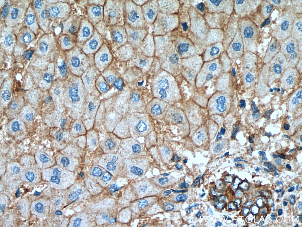 Immunohistochemistry (IHC) staining of human liver tissue using GHR Polyclonal antibody (20713-1-AP)
